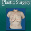 Annals of Plastic Surgery: Volume 88 (1 - 6) 2022 PDF