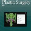 Annals of Plastic Surgery: Volume 90 (1 - 6) 2023 PDF