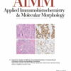 Applied Immunohistochemistry & Molecular Morphology: Volume 30 (1 - 10) 2022 PDF