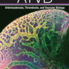 Arteriosclerosis, Thrombosis & Vascular Biology: Volume 42 (1 - 12) 2022 PDF