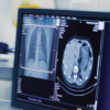 University Of Washington Emergency Radiology Review 2023 (Videos)