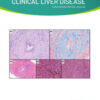 Clinical Liver Disease: Volume 20 (1 - 6) 2022 PDF