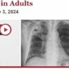 Harvard Infectious Diseases In Adults 2024 (Videos)