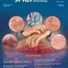 Journal of Allergy and Clinical Immunology PDF