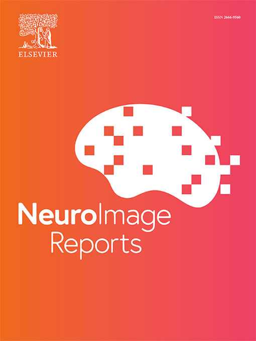 Neuroimage: Reports PDF