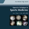 Operative Techniques in Sports Medicine PDF