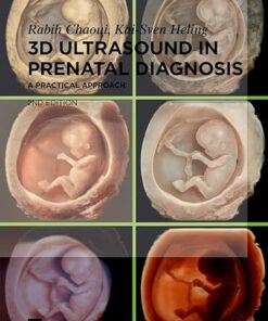 3D Ultrasound in Prenatal Diagnosis: A Practical Approach 2nd edition (PDF)