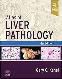 Atlas Of Liver Pathology, 4th Edition (PDF)