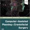 Computer-Assisted Planning In Craniofacial Surgery (PDF)