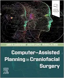 Computer-Assisted Planning In Craniofacial Surgery (PDF)