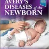 Avery’s Diseases Of The Newborn, 11th Edition (PDF)