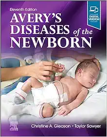 Avery’s Diseases Of The Newborn, 11th Edition (PDF)