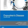 Dupuytren’s Disease: A Scientific Review (PDF)