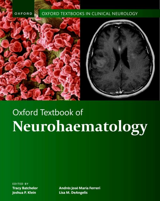 Oxford Textbook Of Neurohaematology (PDF)