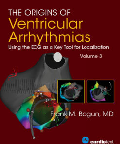 The Origins Of Ventricular Arrhythmias: Using The ECG As A Key Tool For Localization, Volume 3 (PDF)