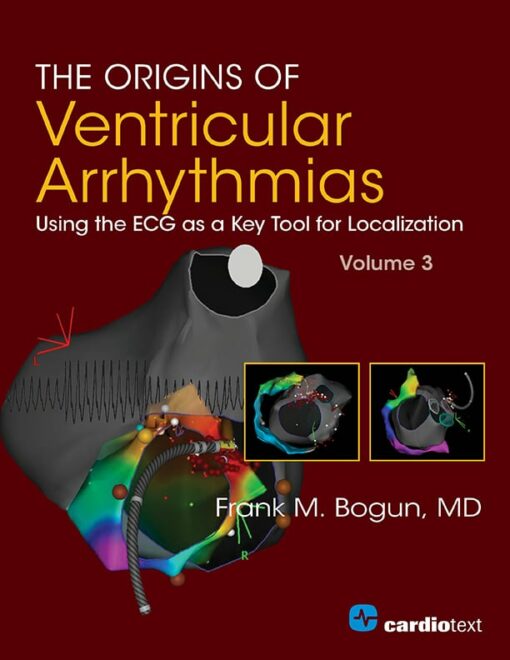 The Origins Of Ventricular Arrhythmias: Using The ECG As A Key Tool For Localization, Volume 3 (EPUB)