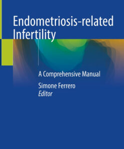 Endometriosis-related InfertilityiA Comprehensive Manual