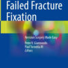 Failed Fracture FixationiRevision Surgery Made Easy