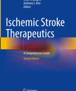 Ischemic Stroke TherapeuticsiA Comprehensive Guide