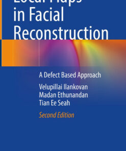 Local Flaps in Facial Reconstruction
A Defect Based Approach