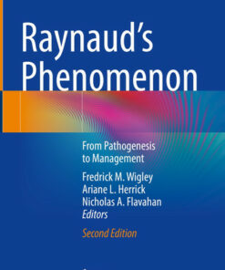 Raynaud’s PhenomenoniFrom Pathogenesis to Management