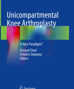 Unicompartmental Knee ArthroplastyiA New Paradigm?