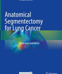 Anatomical Segmentectomy for Lung Cancer
Illustration and Videos