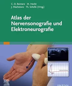 Atlas Der Nervensonografie Und Elektroneurografie (German Edition) (PDF)