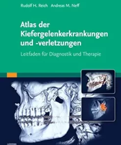 Atlas Der Kiefergelenkerkrankungen Und -Verletzungen: Leitfaden Zur Diagnostik Und Therapie (German Edition) (PDF)