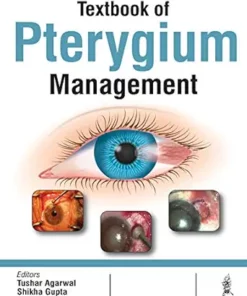 Textbook Of Pterygium Management (PDF)