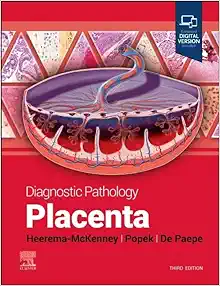 Diagnostic Pathology: Placenta, 3rd Edition (PDF)