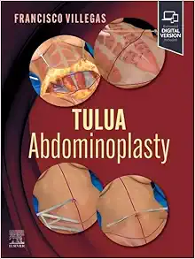 TULUA Abdominoplasty: Transverse Plication Technique (EPUB + Converted PDF)