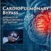 Cardiopulmonary Bypass: Advances In Extracorporeal Life Support (PDF)