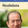 100 Questions & Answers About Mesothelioma, 4th Edition (PDF)