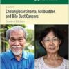 100 Questions & Answers About Cholangiocarcinoma, Gallbladder, And Bile Duct Cancers, 2nd Edition (PDF)