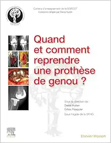 Quand Et Comment Reprendre Une Prothèse De Genou ? (French Edition) (PDF)