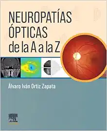 Neuropatías Ópticas De La A A La Z (PDF)