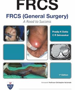 FRCS (General Surgery): A Road to Success (PDF)