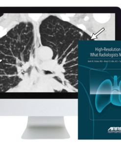 High-Resolution Chest CT 2024