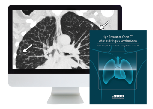 High-Resolution Chest CT 2024