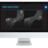 Plexus and Peripheral Nerve Imaging 2024