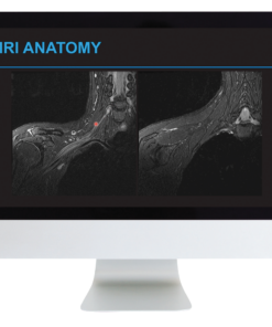 Plexus and Peripheral Nerve Imaging 2024