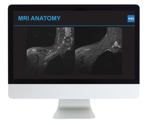 Plexus and Peripheral Nerve Imaging 2024