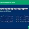 Electroencephalography: Textbook And Atlas (PDF)