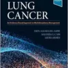 Lung Cancer: An Evidence-Based Approach To Multidisciplinary Management (PDF)