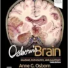 Osborn’s Brain, 3rd Edition (PDF)