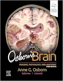 Osborn’s Brain, 3rd Edition (PDF)