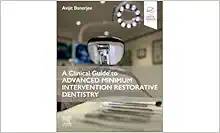 A Clinical Guide To Advanced Minimum Intervention Restorative Dentistry (PDF)