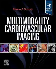 Multimodality Cardiovascular Imaging (EPUB)