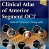 Clinical Atlas Of Anterior Segment OCT: Optical Coherence Tomography (PDF)